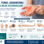 karpal tünel sendromu için el ve bilek egzersizleri